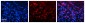 SLC25A4 antibody - N-terminal region